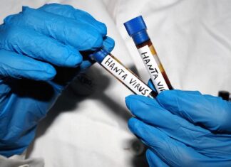 Hantavirus op de MV Hondius: waarom deze uitbraak ernstig is, maar geen pandemie